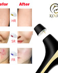 KODO 2023 New Laser Hair removal