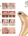 KODO 2024 High-end customization ice Laser Hair removal